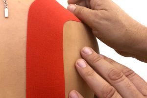 Kinesio taping