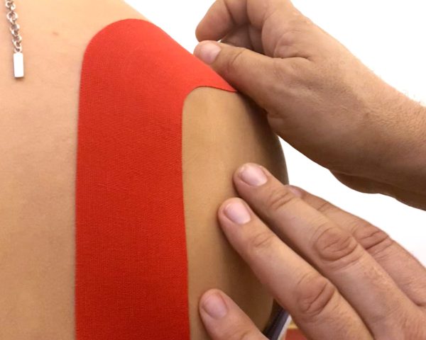 Kinesio taping